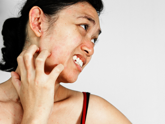 Sensitive Skin in Peri-Menopause: How to Calm the Irritation