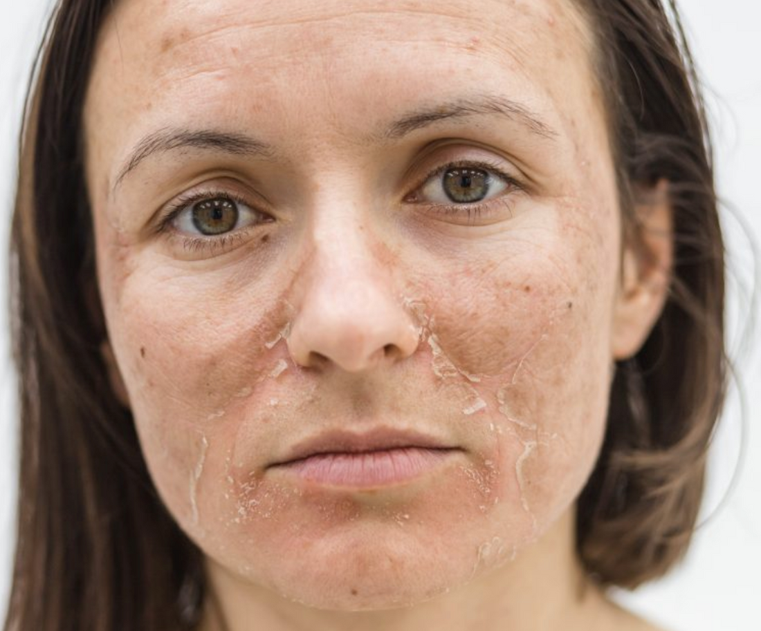 Why Your Skin Barrier Matters: Understanding the Foundation of Skin Health