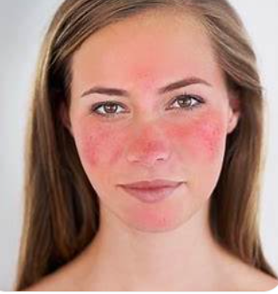 Redness, Flare-Ups & Irritation: What Your Skin Is Trying to Tell You