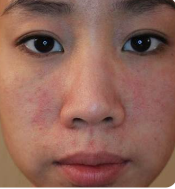 Is This Reaction Normal, or Is My Skin Trying to Tell Me Something's Wrong?