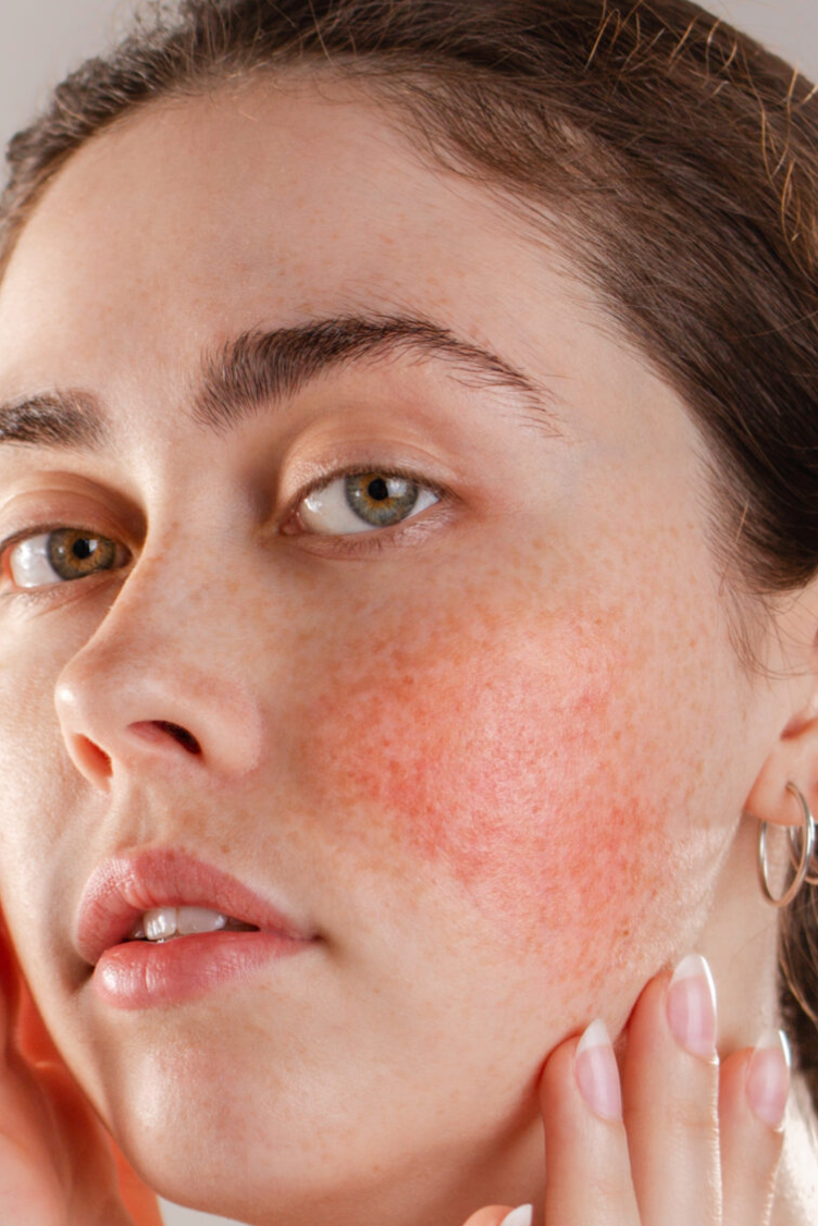 "Caring for Sensitive Skin: Expert Tips That Make a Difference"
