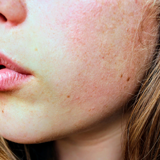 Seasonal Skincare Adjustments: Adapting Professional Treatments to Different Weather Conditions