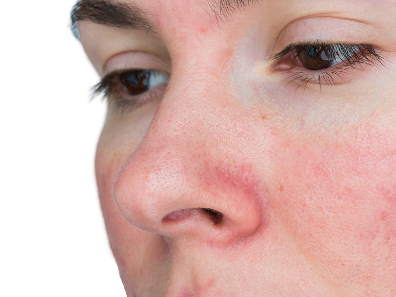 Sensitive Skin 101: How to Calm, Protect, and Strengthen Your Barrier