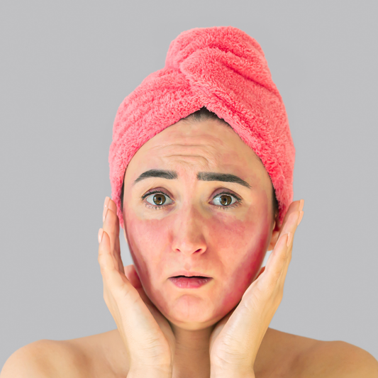 The Link Between Peri-Menopause and Facial Flushing