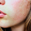 Seasonal Skincare Adjustments: Adapting Professional Treatments to Different Weather Conditions