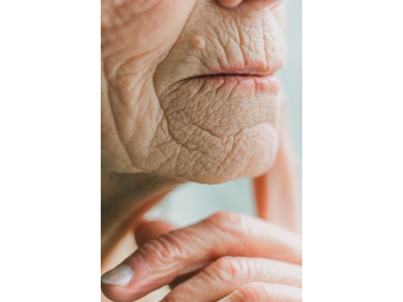 "Fine Lines vs Wrinkles: Understanding the Signs of Skin Maturity"