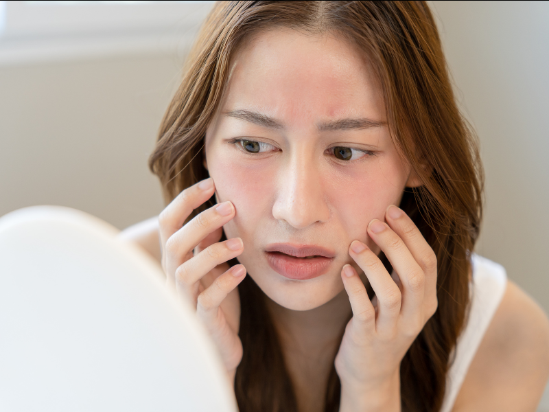 Is Your Skin Overreacting? Understanding Sensitivity and How to Soothe It