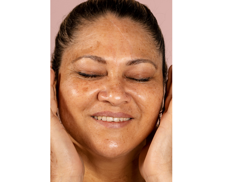 Pigmentation Problems Solved: Your Guide to Brighter, Balanced Skin